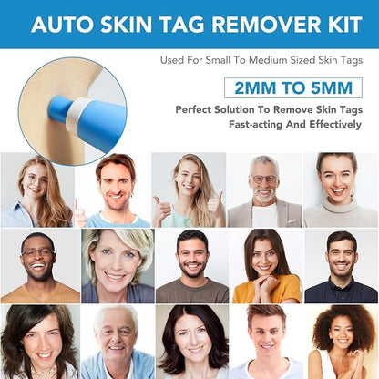 Painless Skin Tag Removal Kit