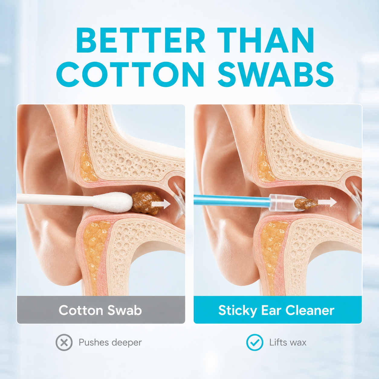 💥BUY 2 GET 1 FREE👂High-Grip Earwax Removal Sticks
